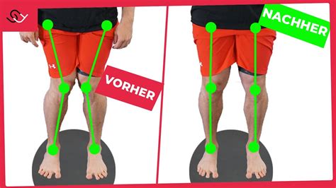X Beine loswerden .